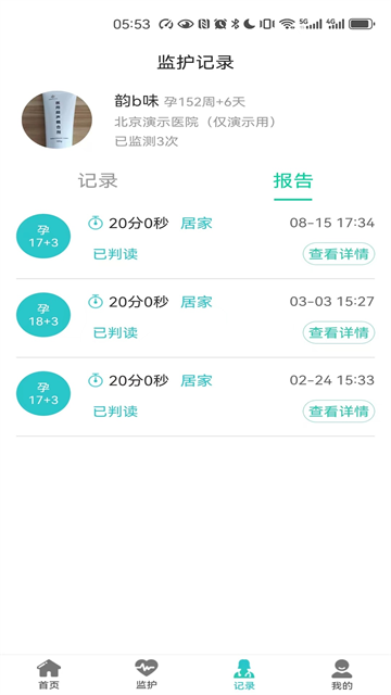 胎心监护app
