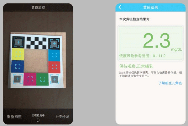 哪吒保贝(测黄疸)